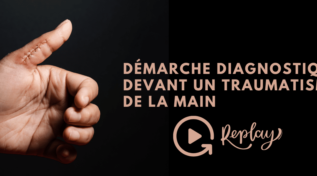 Démarche diagnostique devant un traumatisme de la main